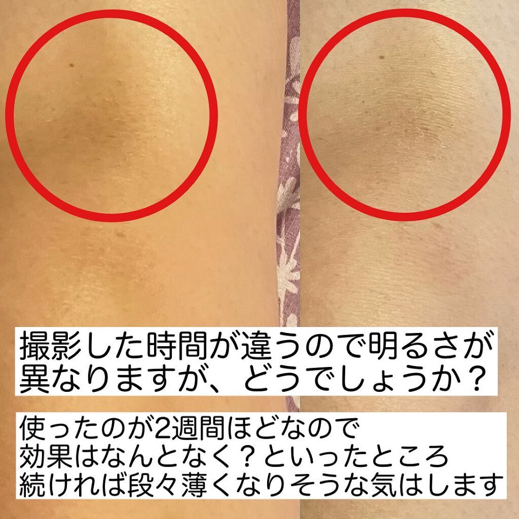 ホワイトニングクリーム/クレアトーン/ボディクリームを使ったクチコミ(4枚目)