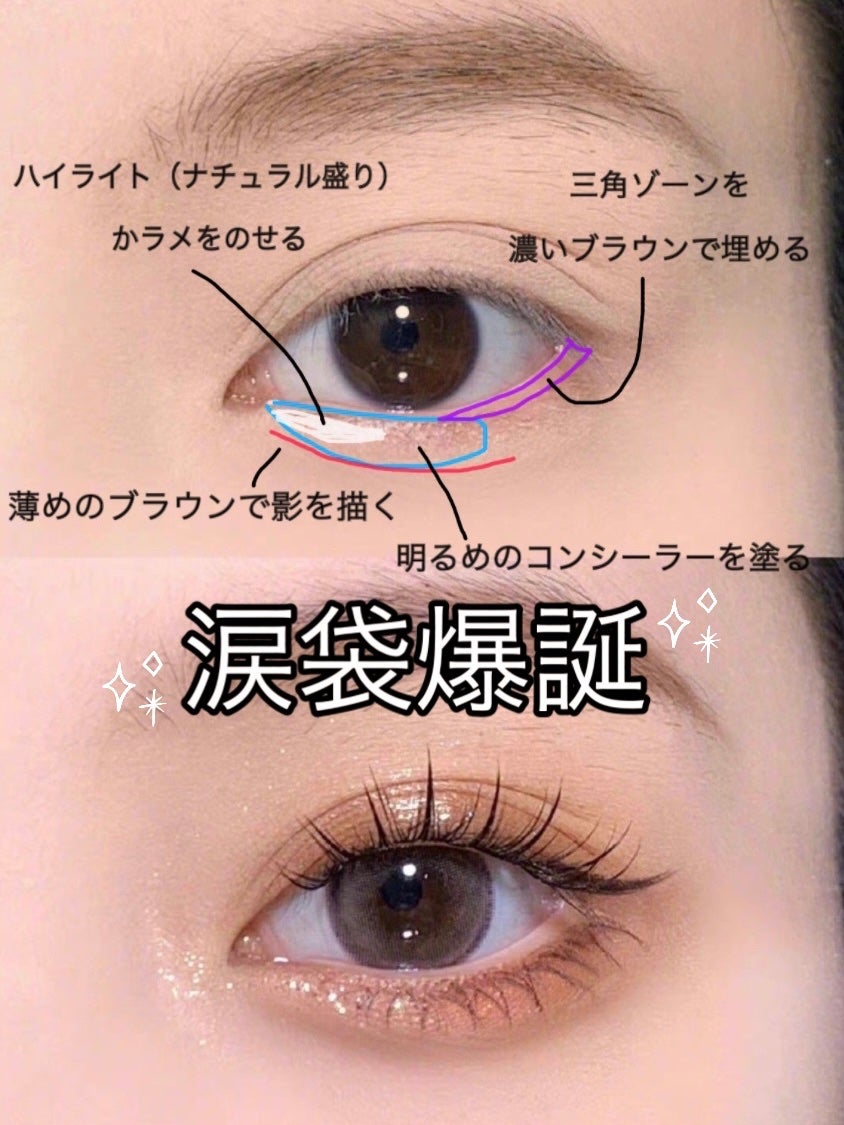 ã¢ã€ããã°ã³ã³ã·ãŒã©ãŒ/ãã£ã³ã¡ã€ã¯/ãã³ã·ã«ã³ã³ã·ãŒã©ãŒã䜿ã£ãã¯ãã³ãïŒ1æç®ïŒ