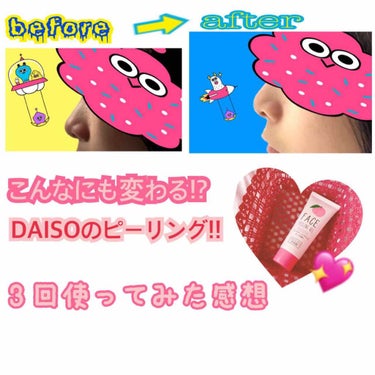 フェイスピーリングジェル ピーチの香り/DAISO/ピーリングを使ったクチコミ（1枚目）