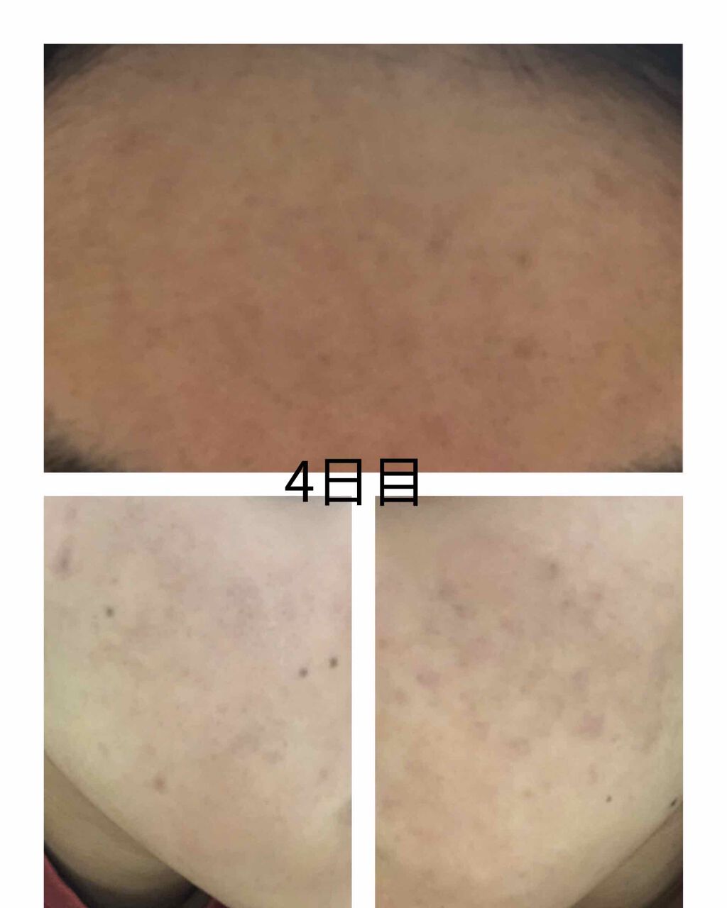 ハトムギ化粧水(ナチュリエ スキンコンディショナー R )/ナチュリエ/化粧水を使ったクチコミ(1枚目)