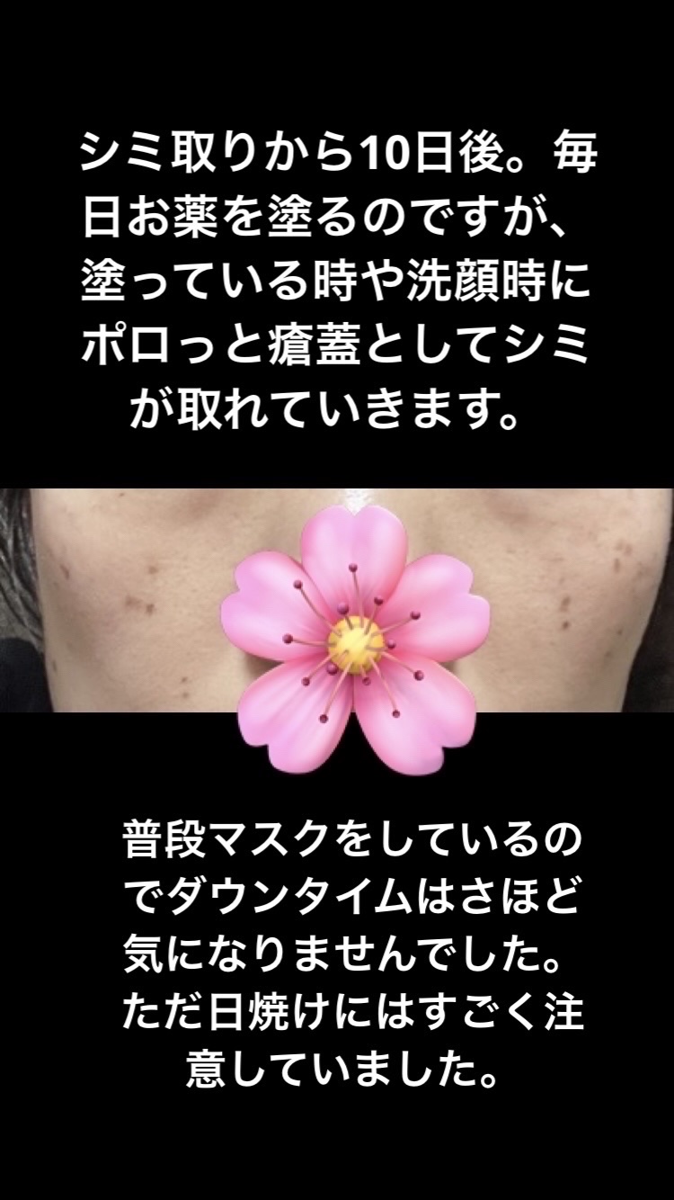 メラノショット W/ONE BY KOSE/美容液を使ったクチコミ（3枚目）