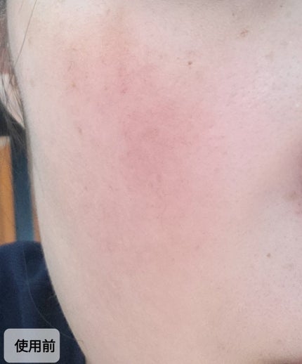 エアリーフィットサンスティック/KAHI/日焼け止めスティックを使ったクチコミ(5枚目)