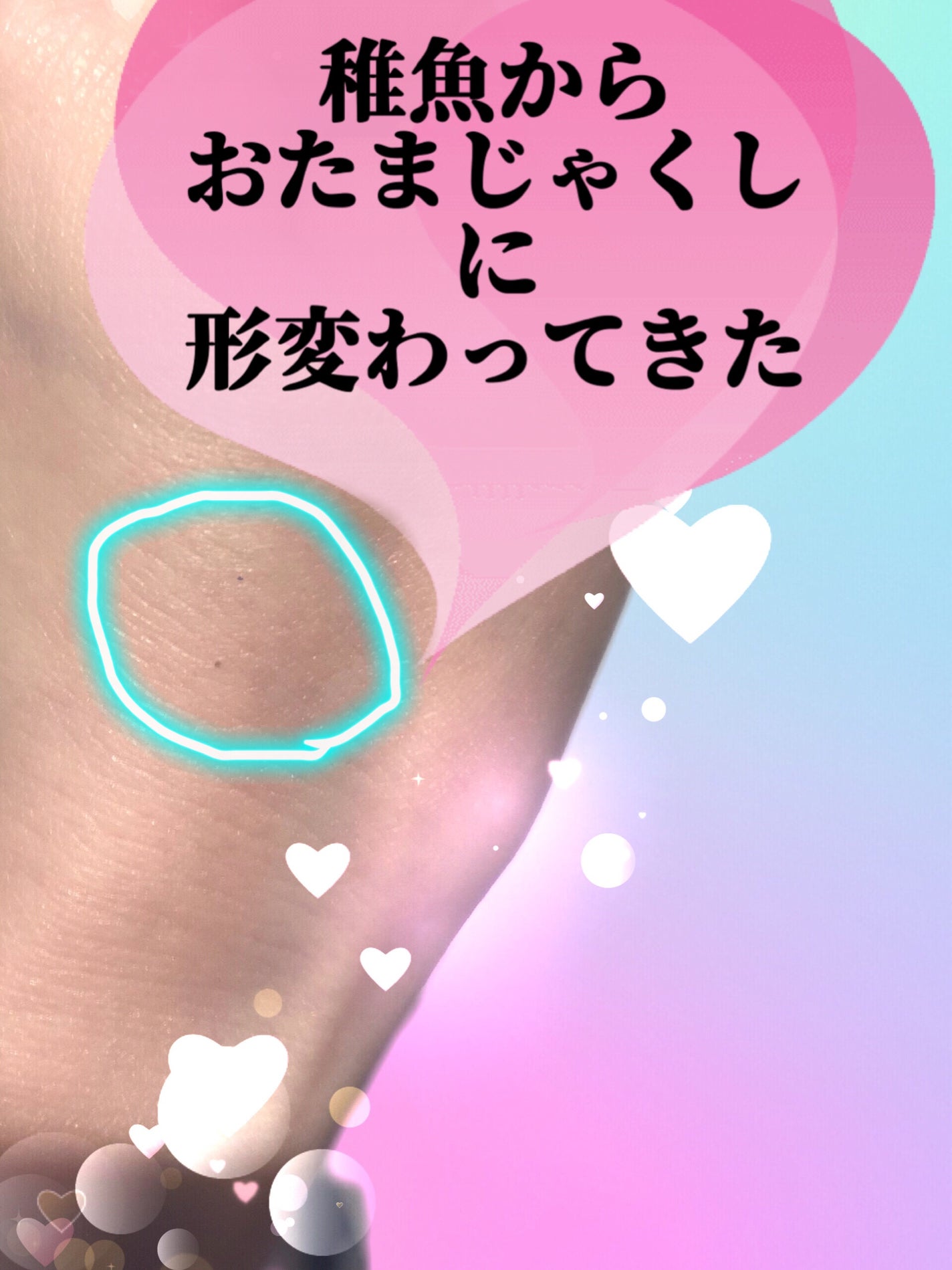 1ステップ ニキビコントロール マキシマム/STRIDEX/ピーリングを使ったクチコミ(1枚目)