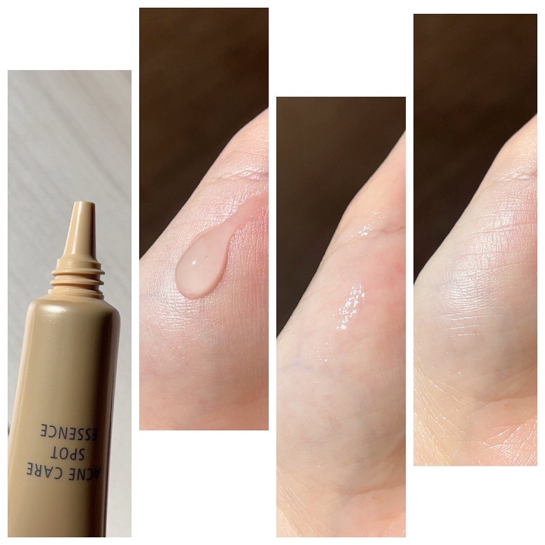 薬用 アクネケア美容液/d プログラム/美容液を使ったクチコミ（2枚目）