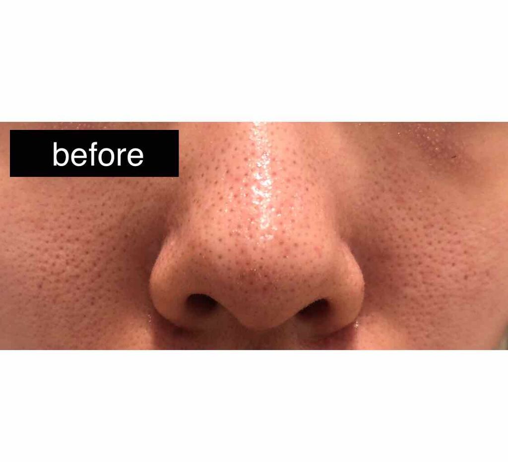 フェイシャル トリートメント クリア ローション/SK-II/化粧水を使ったクチコミ(2枚目)