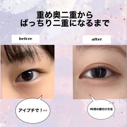 オリシキ アイリッドスキンフィルム		/D-UP/二重まぶた用アイテムを使ったクチコミ(1枚目)