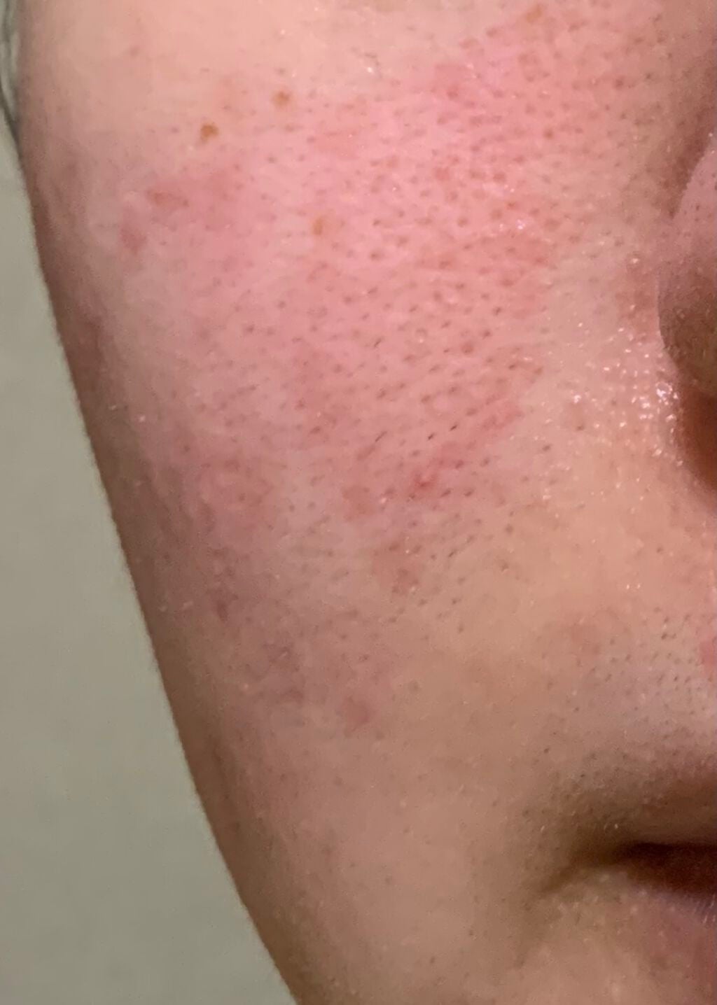 アミノ酸浸透ジェル/Mマークシリーズ/フェイスクリームを使ったクチコミ(3枚目)