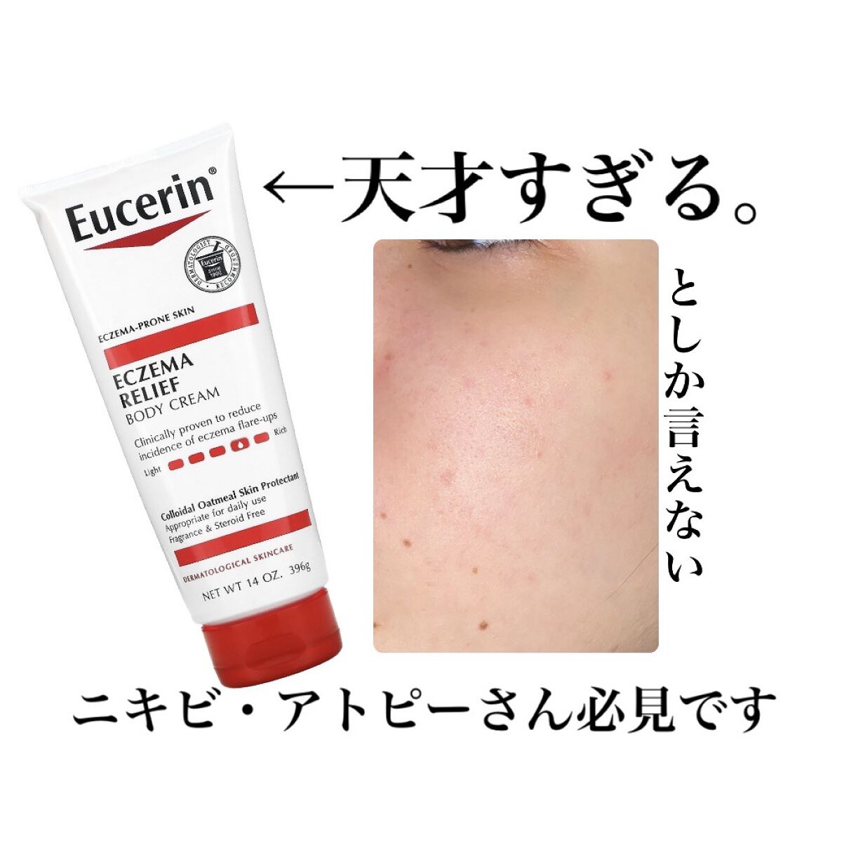 エクゼマリリーフボディクリーム/Eucerin/その他スキンケアを使ったクチコミ（1枚目）