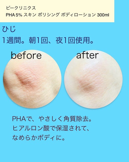 pha 5% ボディーローション/b.clinicx/ボディローションを使ったクチコミ(4枚目)