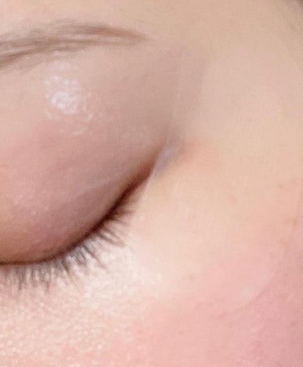 W+ マイクロ ニードル パッチ/SNP/アイケア・アイクリームを使ったクチコミ(6枚目)