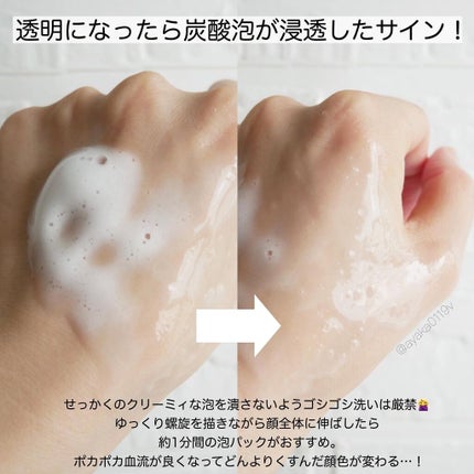 ソフィーナ iP リニュー ムース ウォッシュ/SOFINA iP/泡洗顔を使ったクチコミ(3枚目)