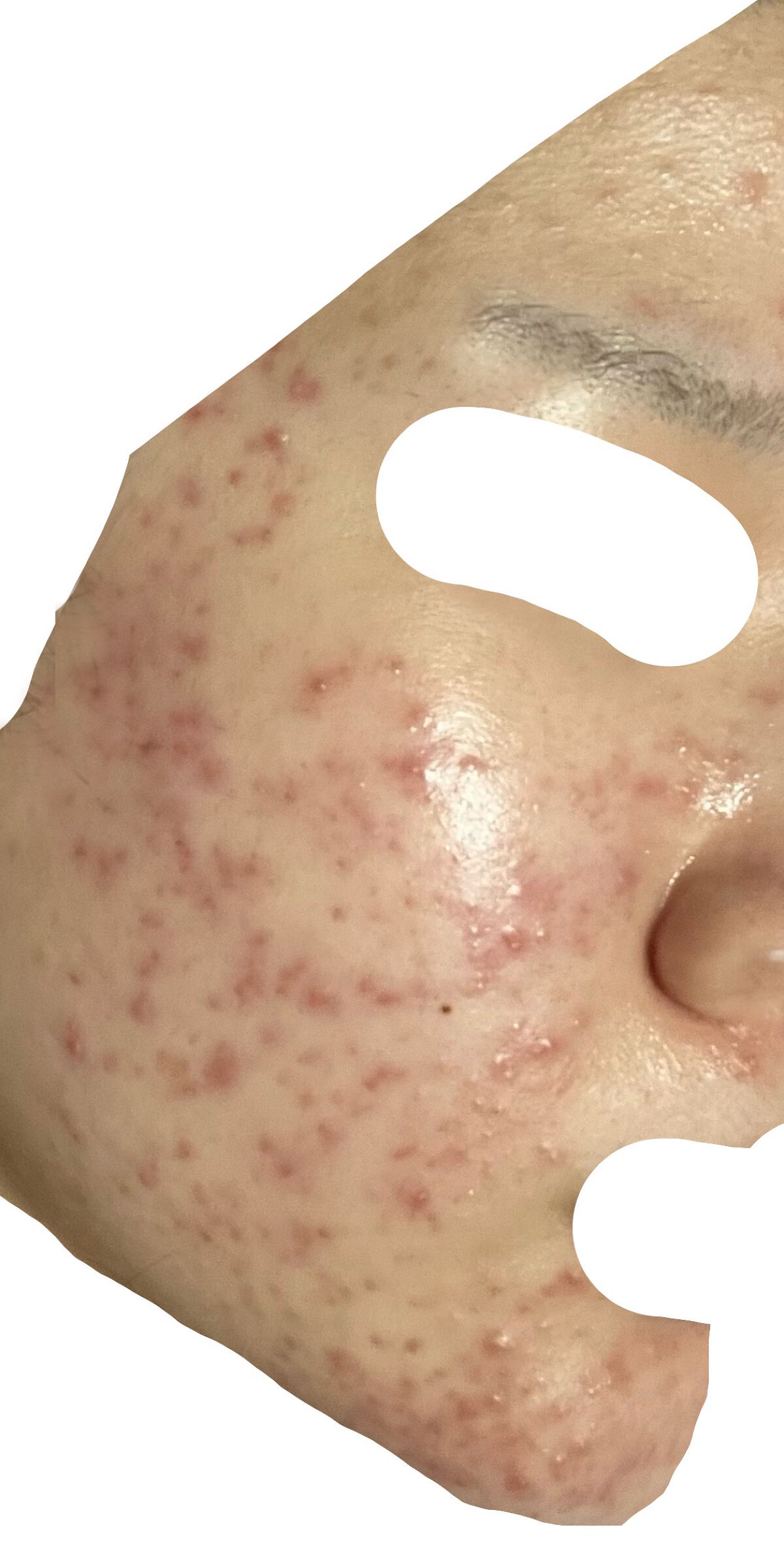 薬用ローション（とてもしっとり）/IHADA/化粧水を使ったクチコミ（2枚目）