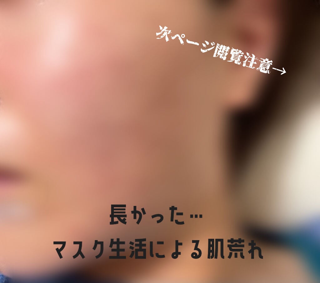 モイスチュア ローション/カルテHD/化粧水を使ったクチコミ(1枚目)