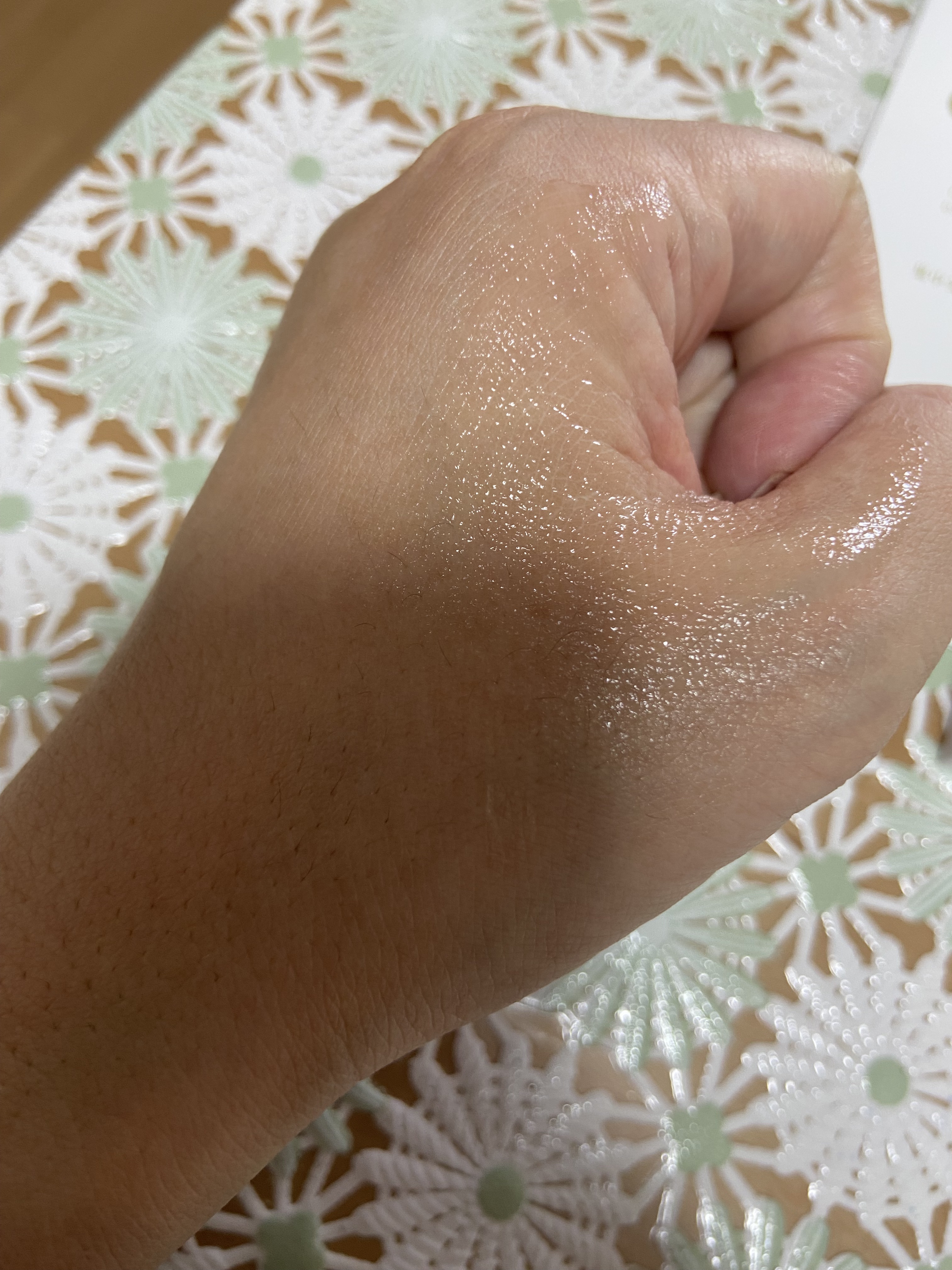 シナールエクシア　ホワイトメディカルエッセンス/シオノギ製薬/美容液を使ったクチコミ（3枚目）