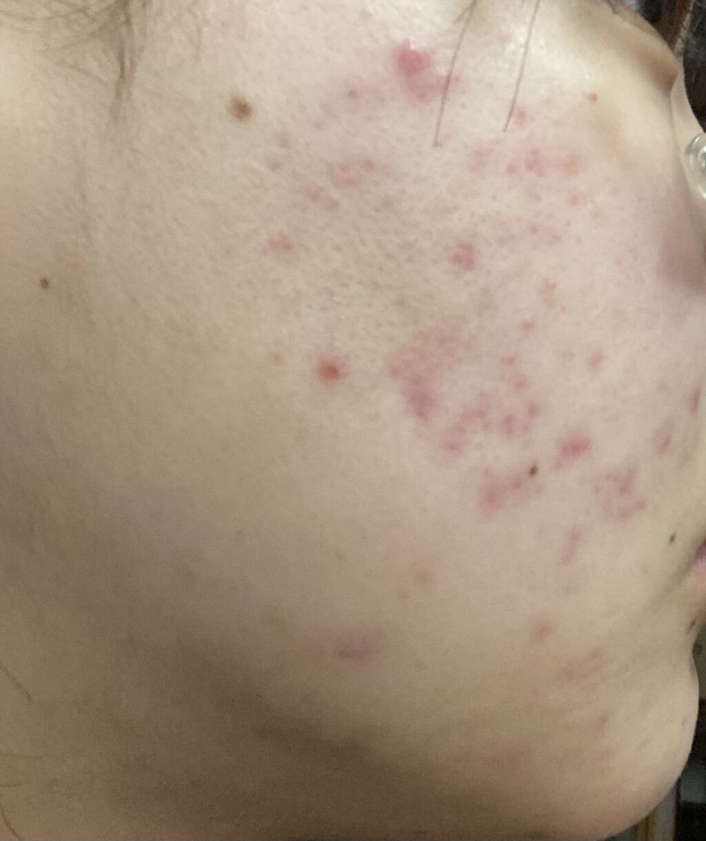 保湿クリーム /ちふれ/フェイスクリームを使ったクチコミ（2枚目）