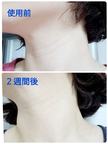 レチノール エキスパート0.1%/IOPE/美容液を使ったクチコミ(4枚目)