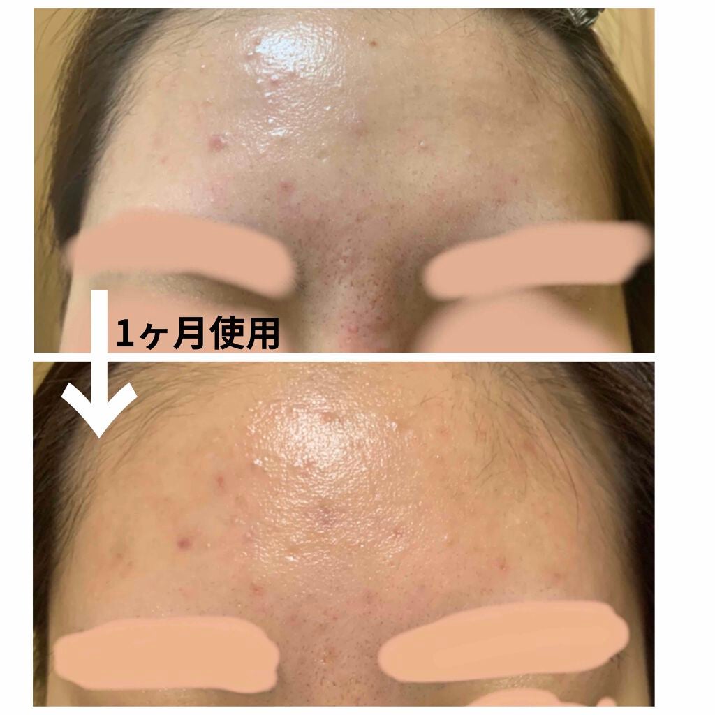 モイスチャージェル2/エンビロン/フェイスクリームを使ったクチコミ(2枚目)