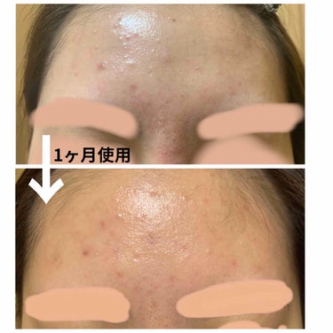 試してみた】モイスチャークリーム2/エンビロンのリアルな口コミ ...