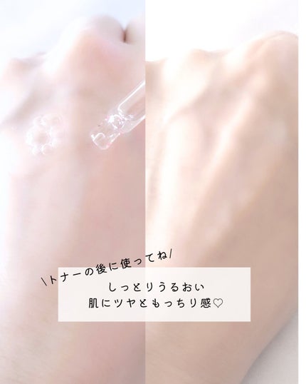 ピンクアロエムチンセラム/APRILSKIN/美容液を使ったクチコミ(9枚目)