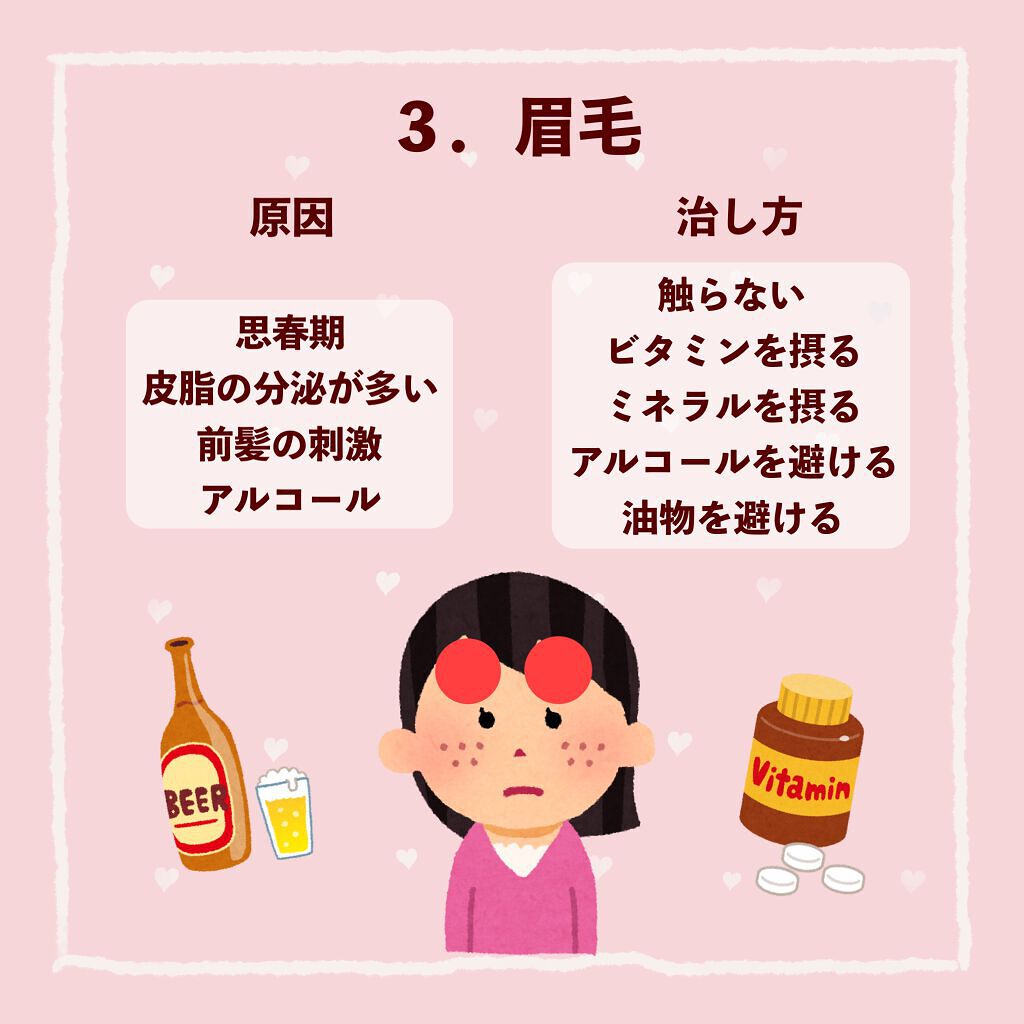 ペアアクネクリームW(医薬品)/ペア/その他を使ったクチコミ(4枚目)