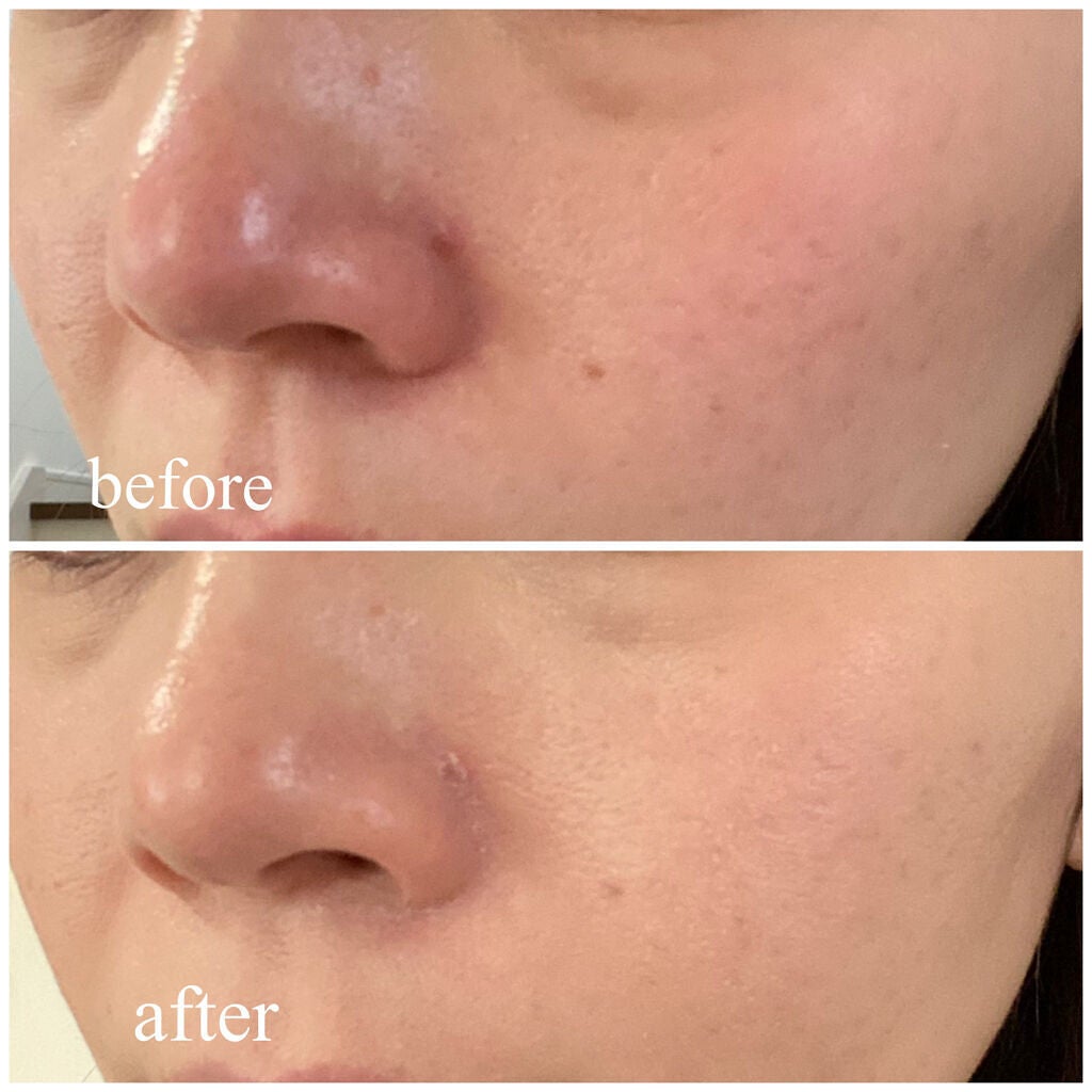 スキンブライト クリーム CC/COVERMARK/CCクリームを使ったクチコミ(3枚目)