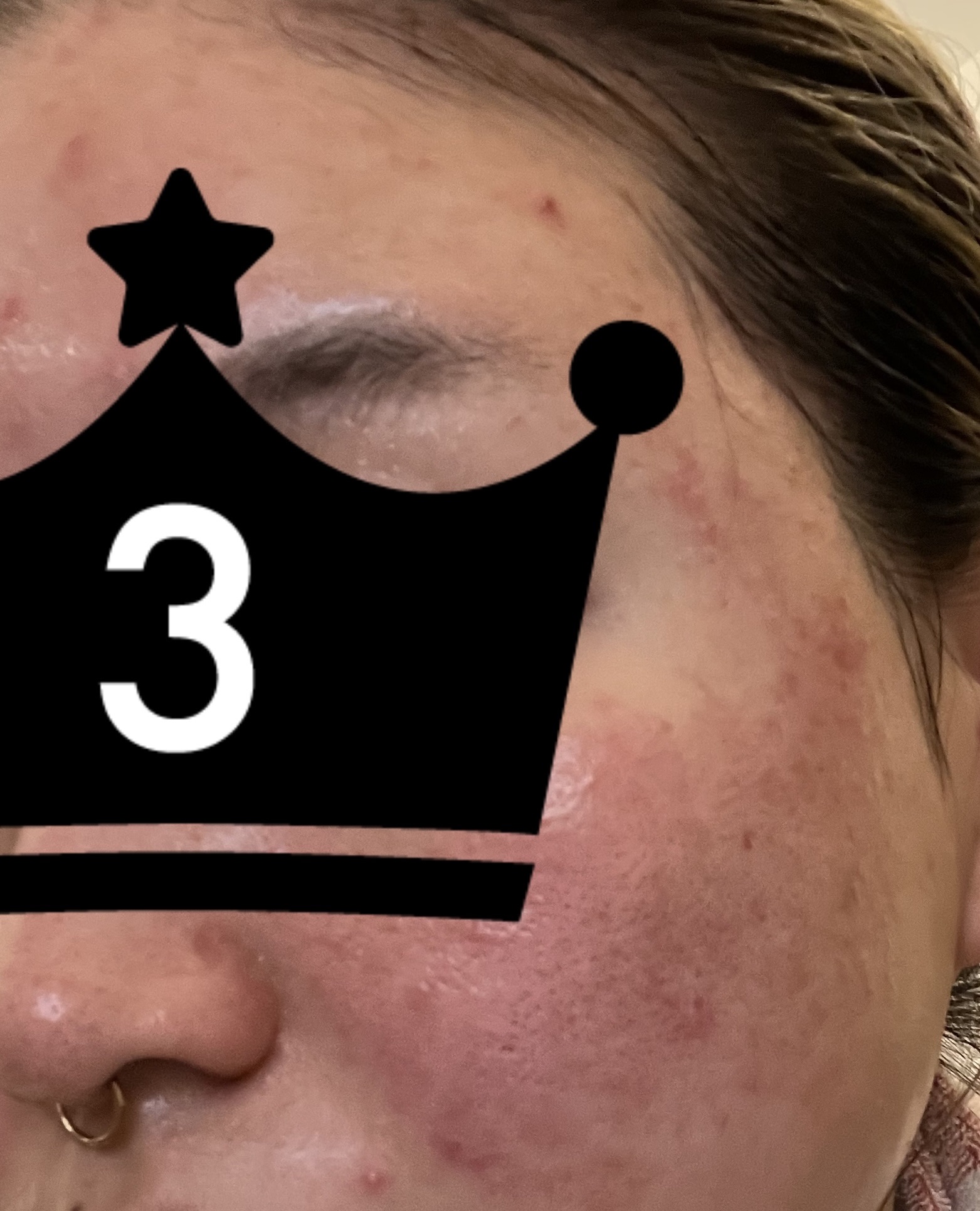 イドラクラリティ　薬用 トリートメント エッセンス ウォーター/DECORTÉ/化粧水を使ったクチコミ（2枚目）