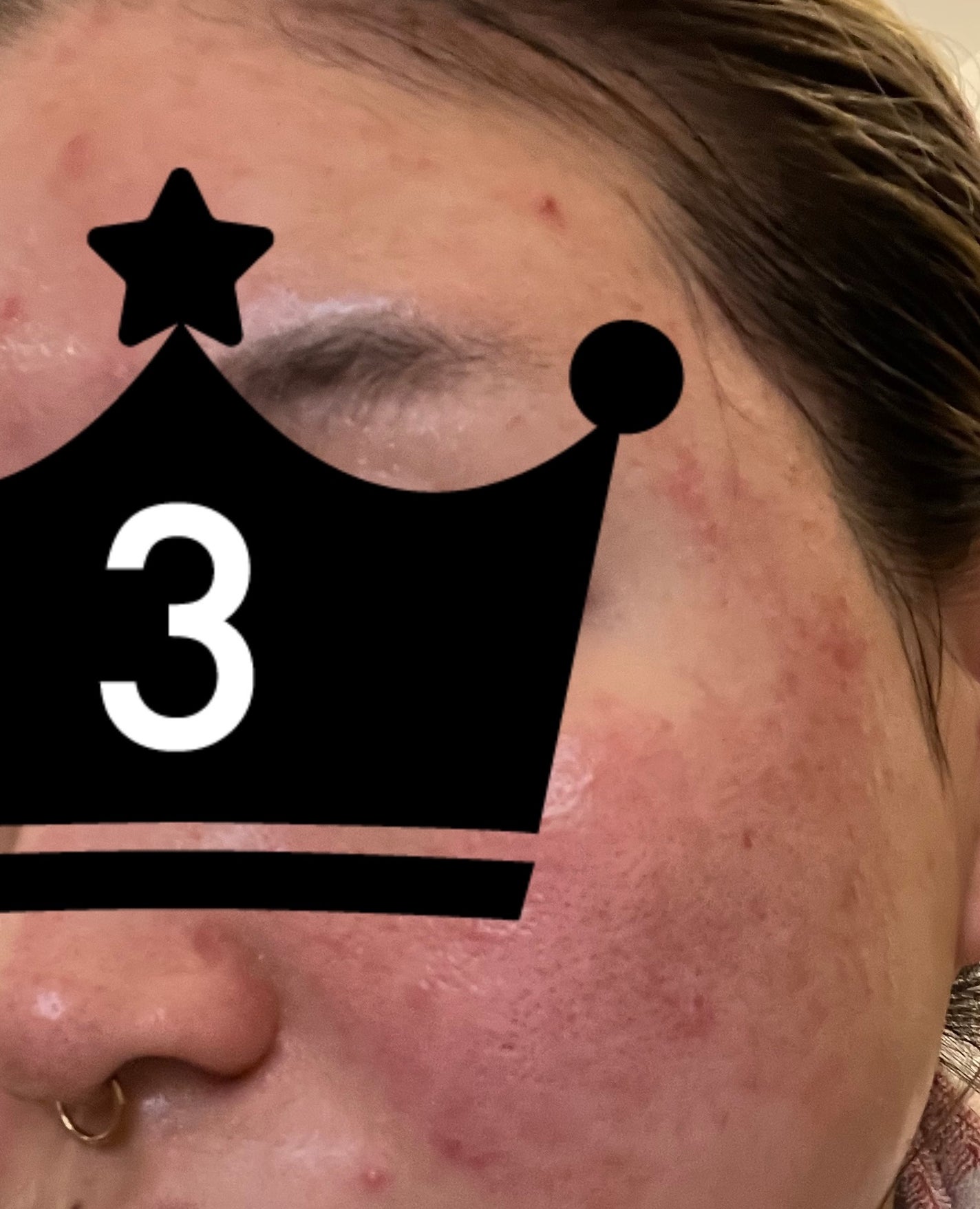 オードムーゲ 薬用ローション(ふきとり化粧水)/オードムーゲ/拭き取り化粧水を使ったクチコミ(2枚目)