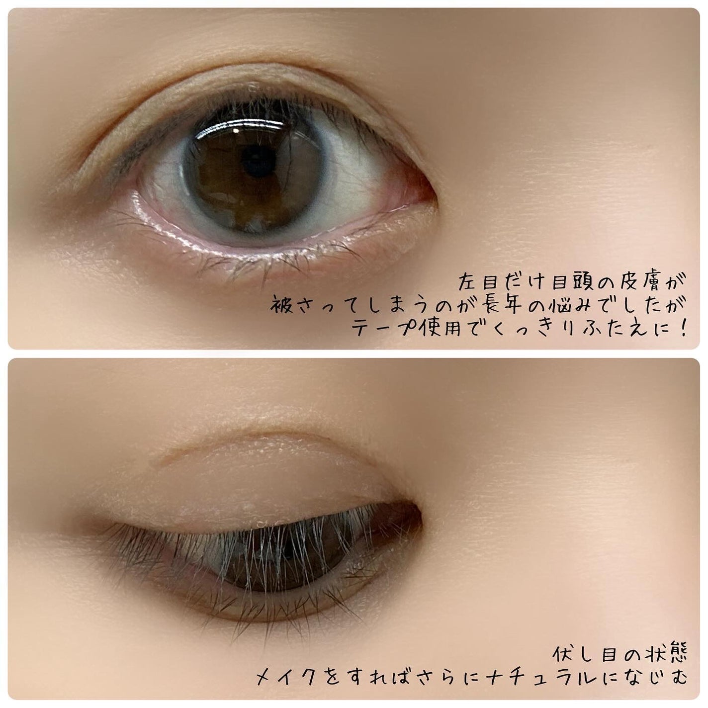 ワンダーアイリッドテープ Extra/D-UP/二重まぶた用アイテムを使ったクチコミ(5枚目)