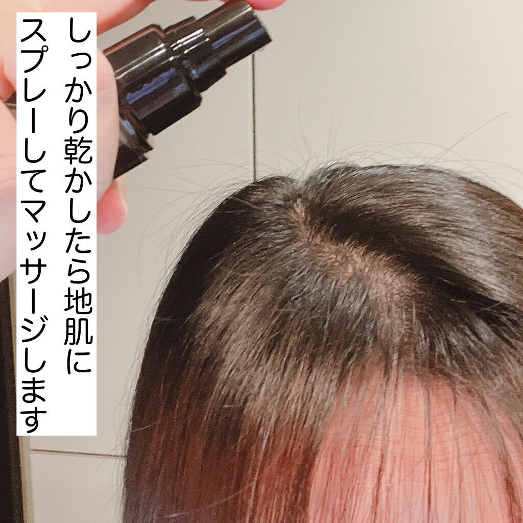 モウダス 薬用 発毛促進剤/北の快適工房/頭皮ローションを使ったクチコミ(6枚目)