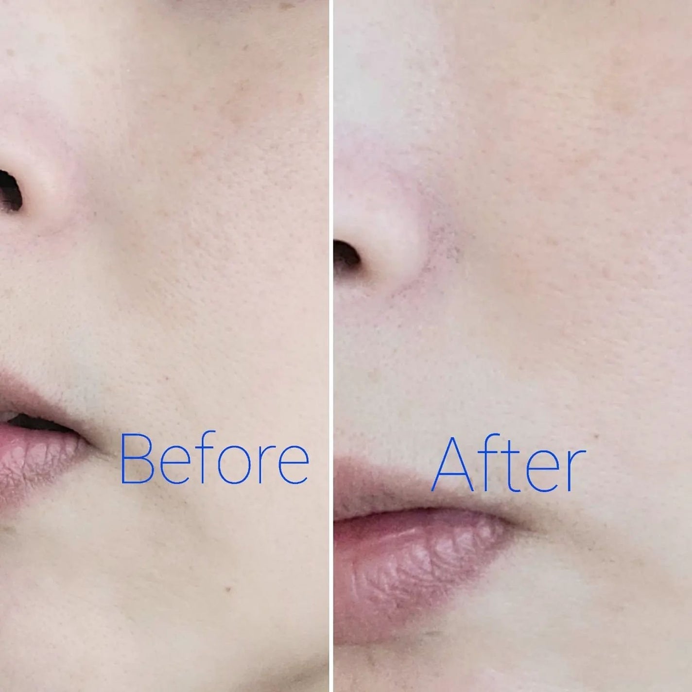 スノーライトEX/VITOWA/洗い流すパック・マスクを使ったクチコミ(8枚目)