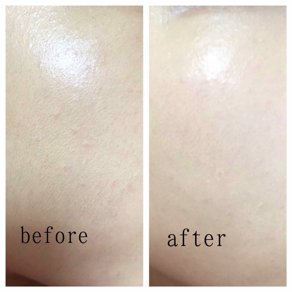 ビタライトビームエッセンシャルマスクEX/MEDIHEAL/シートマスク・パックを使ったクチコミ(2枚目)