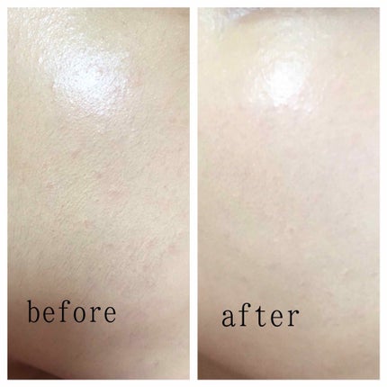 ビタライトビームエッセンシャルマスクEX/MEDIHEAL/シートマスク・パックを使ったクチコミ(2枚目)