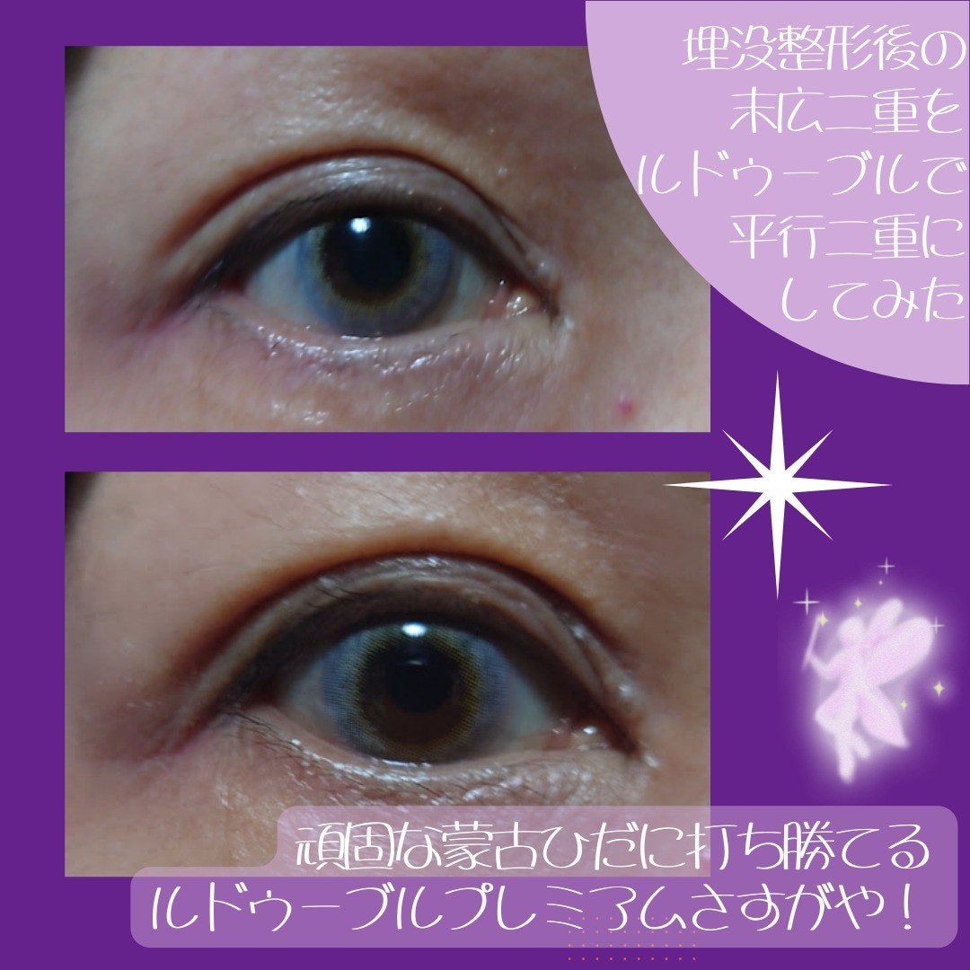ルドゥーブル プレミアム/ルドゥーブル/二重まぶた用アイテムを使ったクチコミ(3枚目)