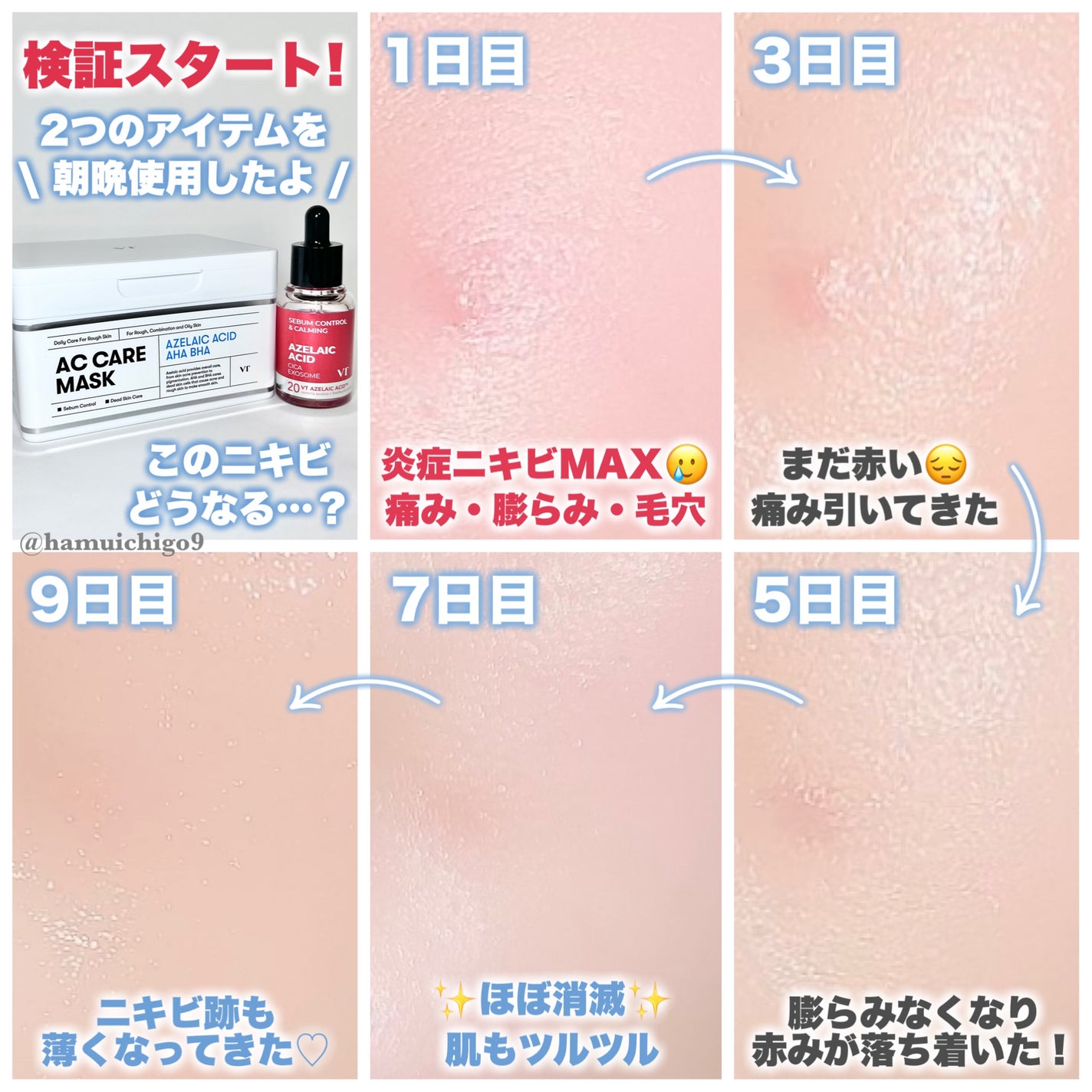 プロCICA クリアスポットパッチ/VT/その他スキンケアを使ったクチコミ(3枚目)