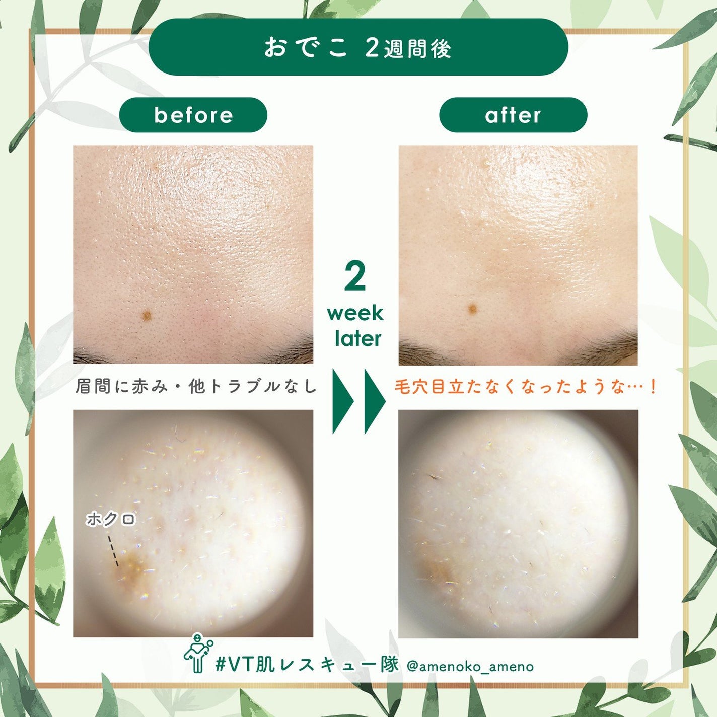 CICA デイリースージングマスク/VT/シートマスク・パックを使ったクチコミ(6枚目)