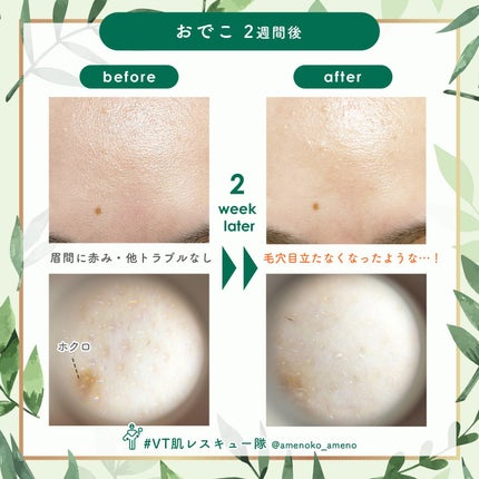 CICA デイリースージングマスク/VT/シートマスク・パックを使ったクチコミ(6枚目)