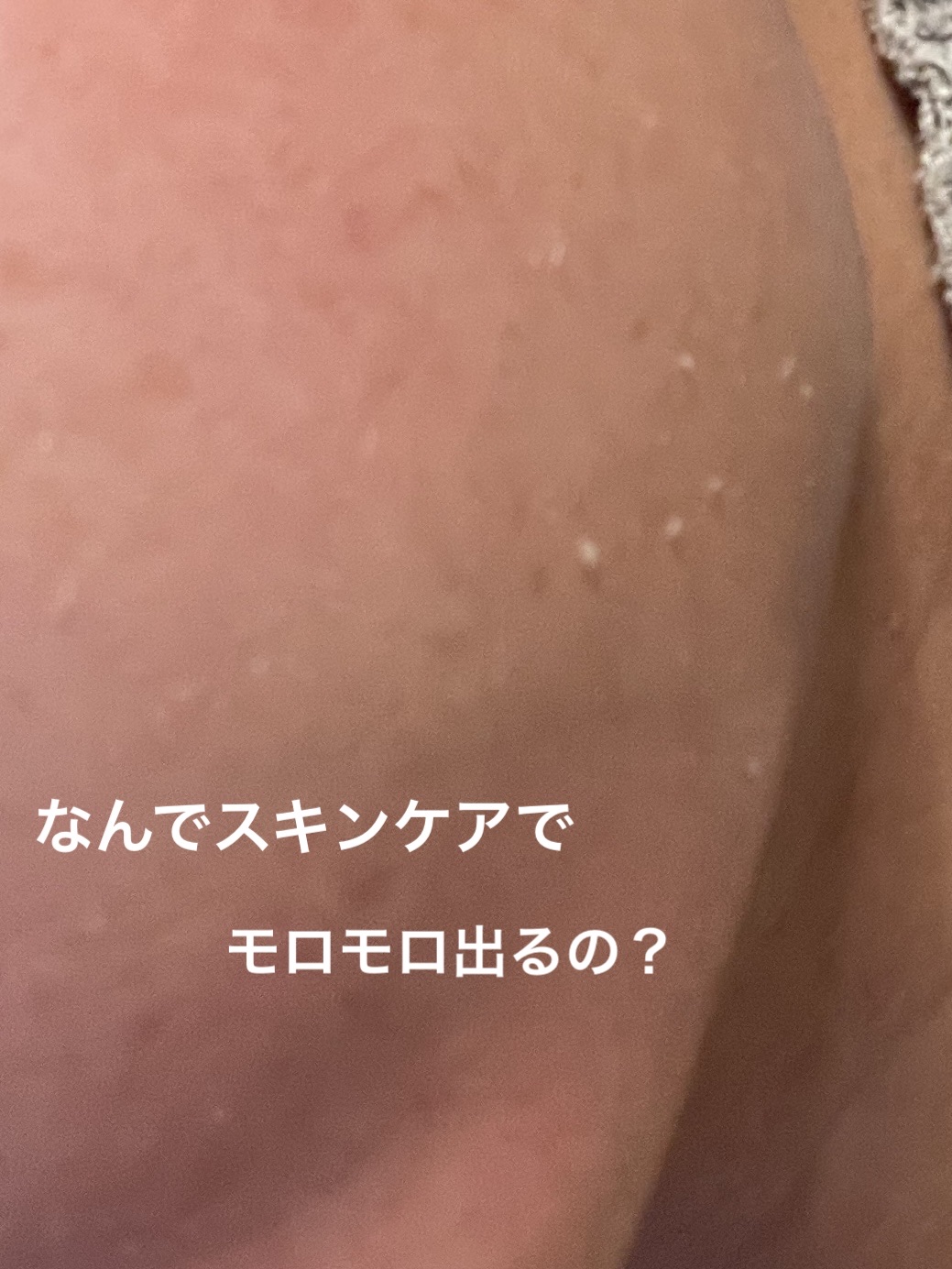 3ミニッツマスク：アクアマイドwith N.M.F/MEDIHEAL/シートマスク・パックを使ったクチコミ（1枚目）