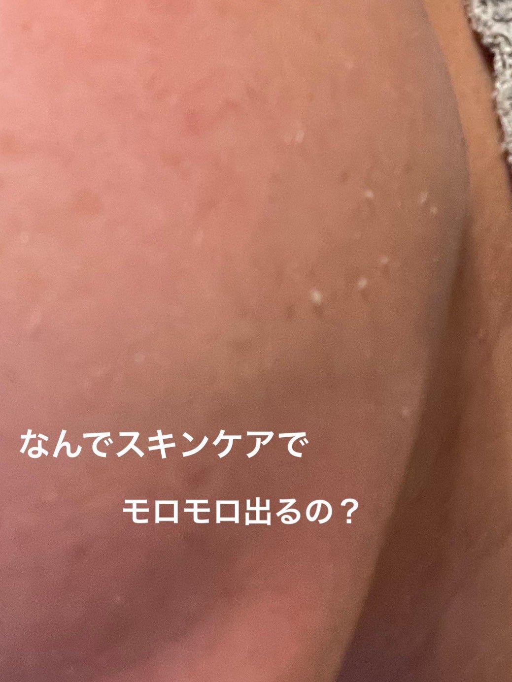 3ミニッツマスク:アクアマイドwith N.M.F/MEDIHEAL/シートマスク・パックを使ったクチコミ(1枚目)