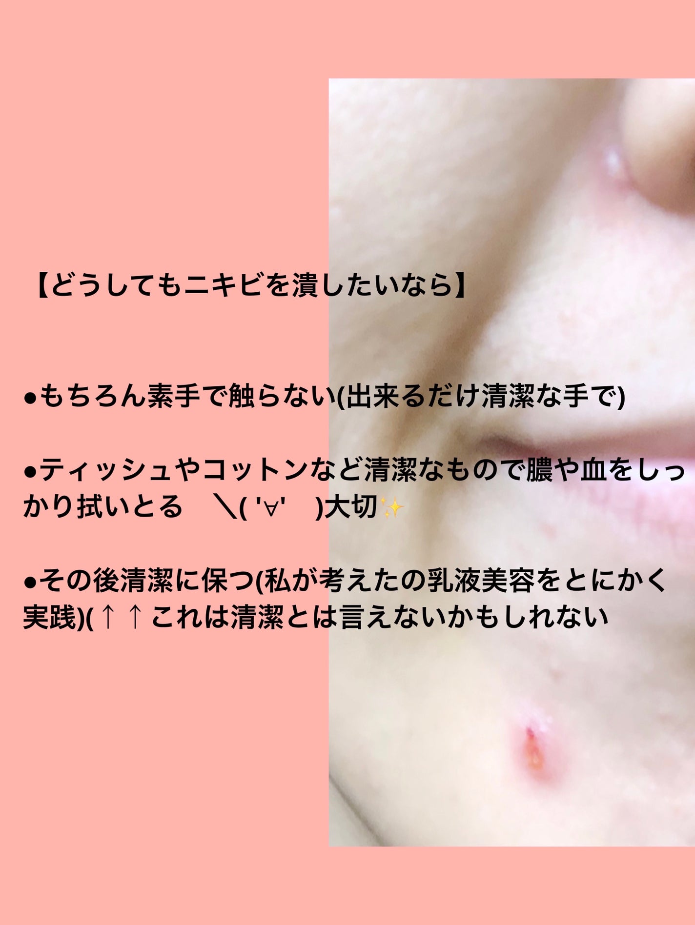 ハトムギ浸透乳液(ナチュリエ スキンコンディショニングミルク)/ナチュリエ/乳液を使ったクチコミ(5枚目)