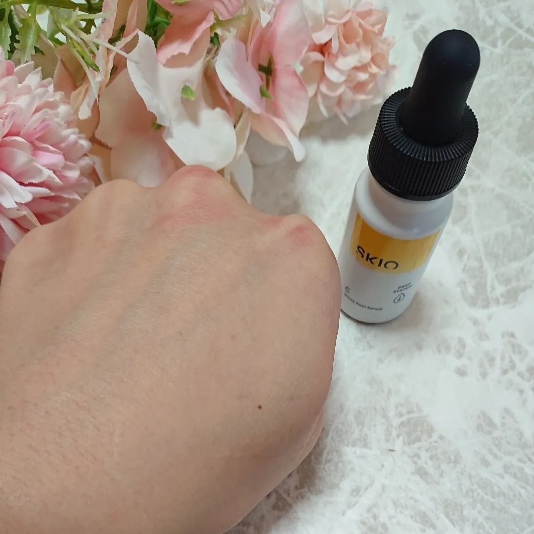 SKIOトライアルキット/SKIO/トライアルキットを使ったクチコミ(8枚目)