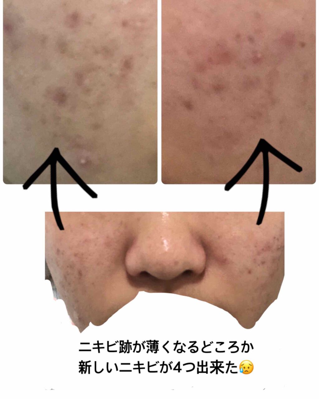 7 day Special Set プログラム3/b.glen/トライアルキットを使ったクチコミ(3枚目)