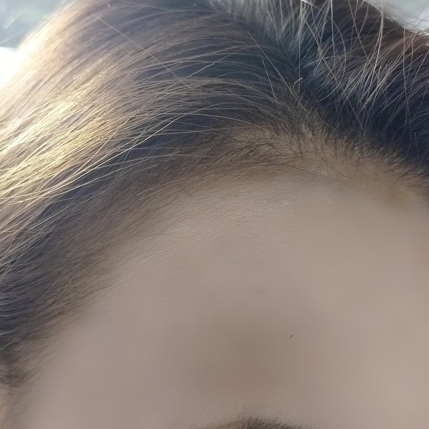 薬用 RJ地肌ケア エッセンス /アピセラピーコスメティクス/頭皮ローションを使ったクチコミ(3枚目)