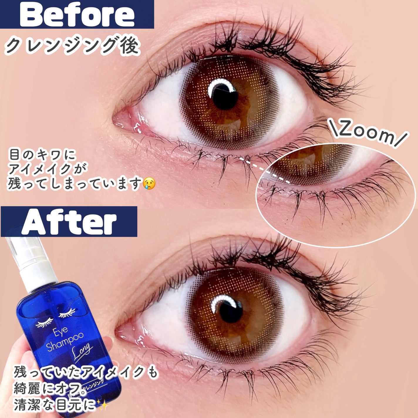 アイシャンプーロング/メディプロダクト/その他洗顔料を使ったクチコミ(6枚目)