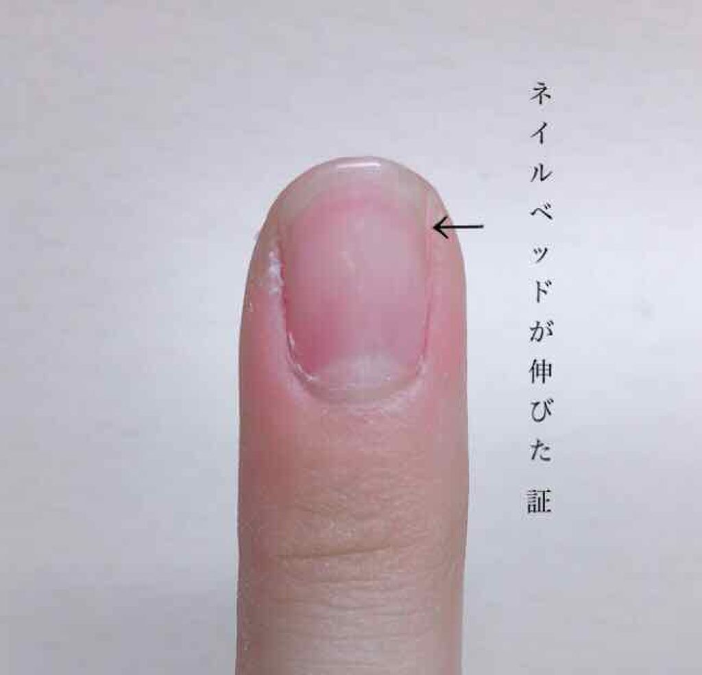 オリジナル ピュアスキンジェリー/ヴァセリン/ボディクリームを使ったクチコミ(2枚目)