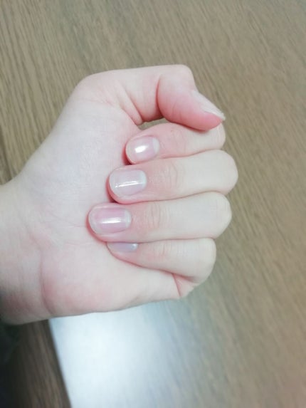 エルファー ネイルキッスA/DAISO/除光液を使ったクチコミ(2枚目)