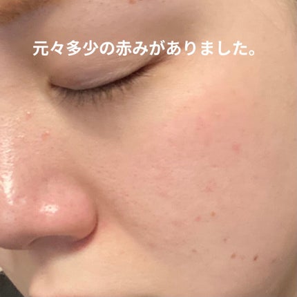 CICA デイリースージングマスク/VT/シートマスク・パックを使ったクチコミ(3枚目)