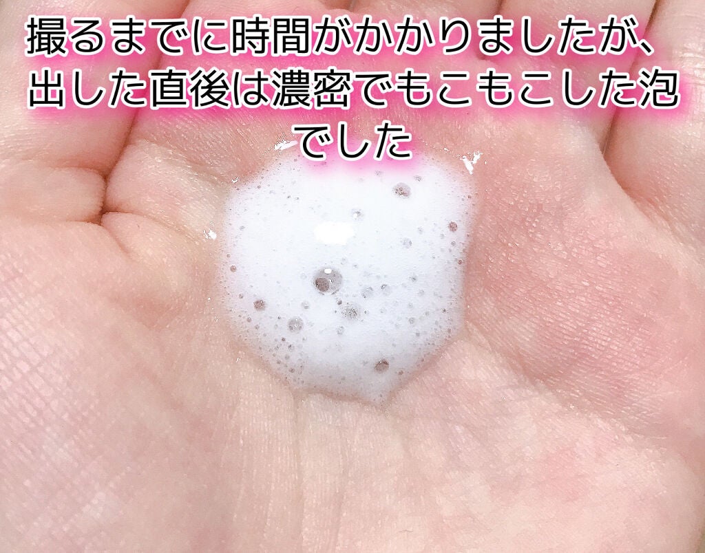 炭酸ヘッドスパシャンプー/トリートメント/肌ナチュール/市販シャンプーを使ったクチコミ(2枚目)