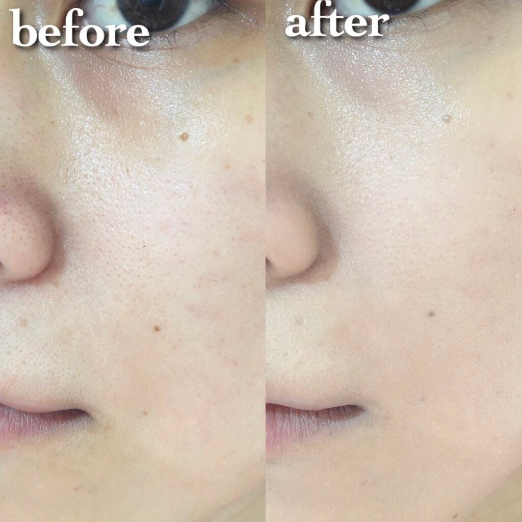 ピンクティーツリーカバークッション/APLIN/クッションファンデーションを使ったクチコミ(5枚目)