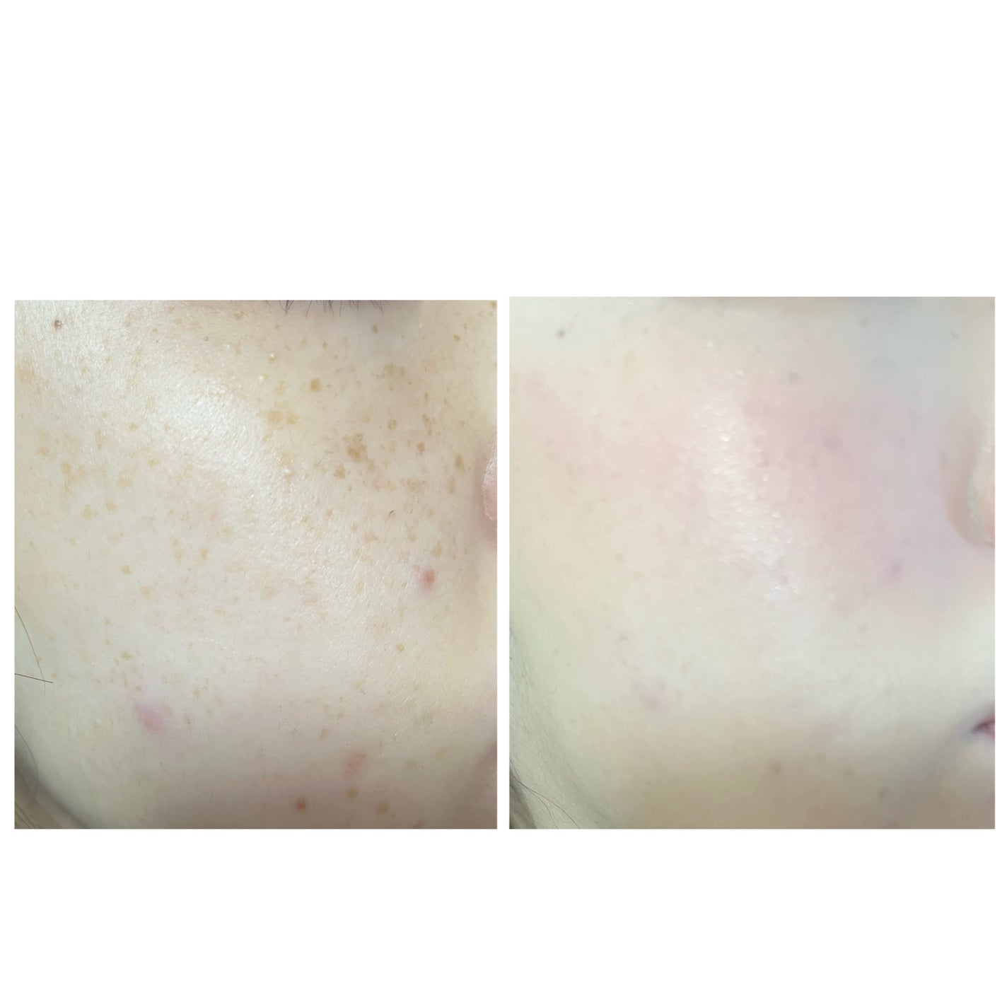 ロングラスティングチップコンシーラー/LUNA/リキッドコンシーラーを使ったクチコミ(2枚目)