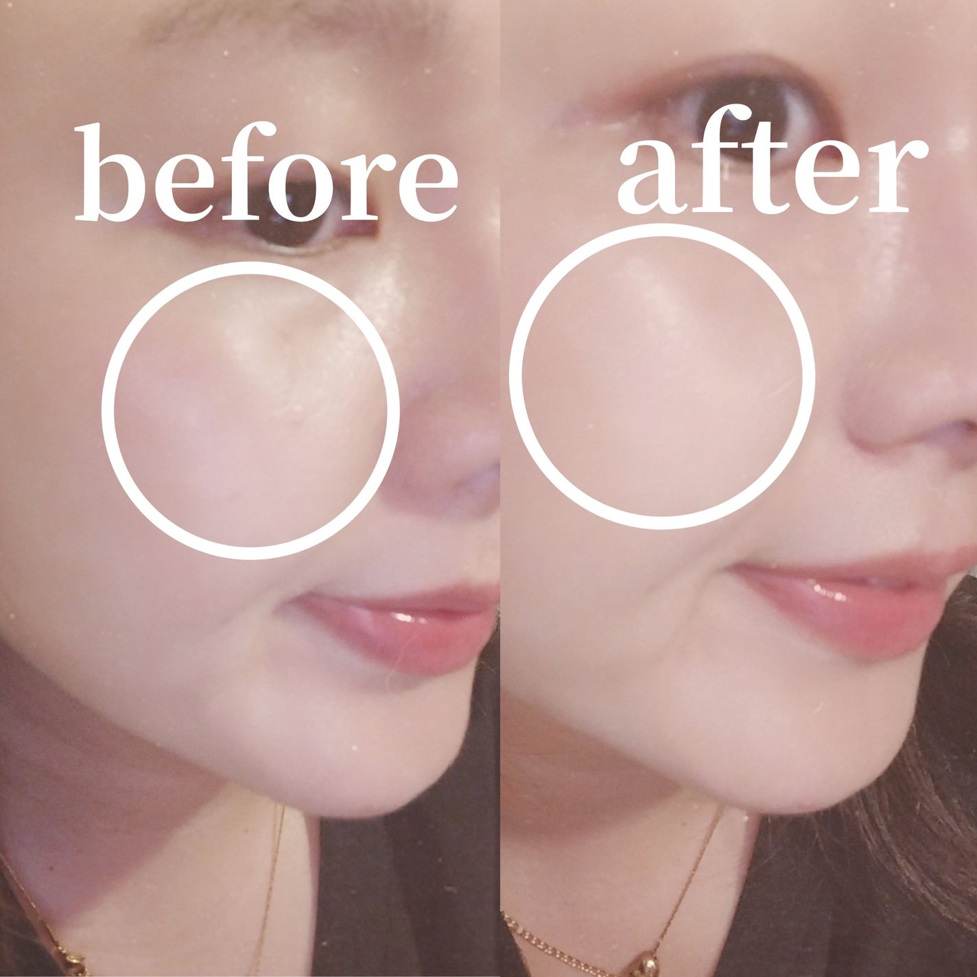 ヌーディステディクッション/SUREBASE/クッションファンデーションを使ったクチコミ(7枚目)